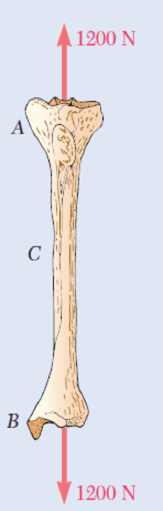 Chapter 1.2, Problem 5P, A strain gage located at C on the surface of bone AB indicates that the average normal stress in the 