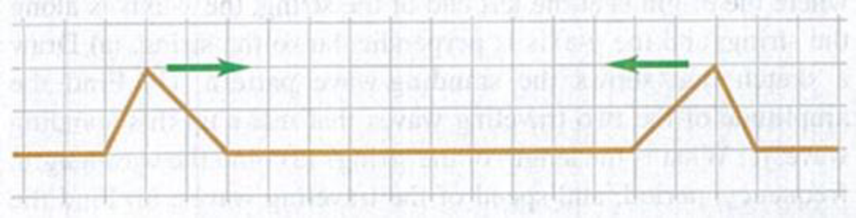 Chapter 15, Problem 15.34E, Two pulses are moving in opposite directions at 1.0 cm/s on a taut string, as shown in Fig. E15.34. 