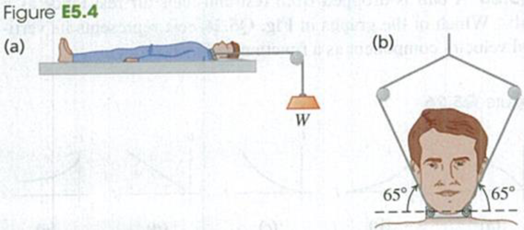 Chapter 5, Problem 5.4E, BIO Injuries to the Spinal Column. In the treatment of spine injuries, it is often necessary to 