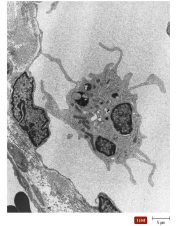 Chapter 16, Problem 2VI, The nearby image is a transmission electron micrograph of a dendritic cell. Indicate where a 