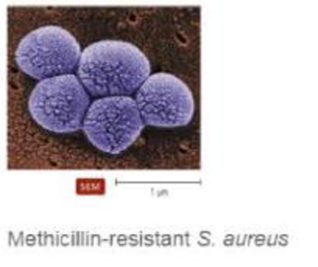 Chapter 19, Problem 1CCS, Clinical Case Study A Fatal Case of Methicillin-Resistant Staphylococcus aureus (MRSA) A 