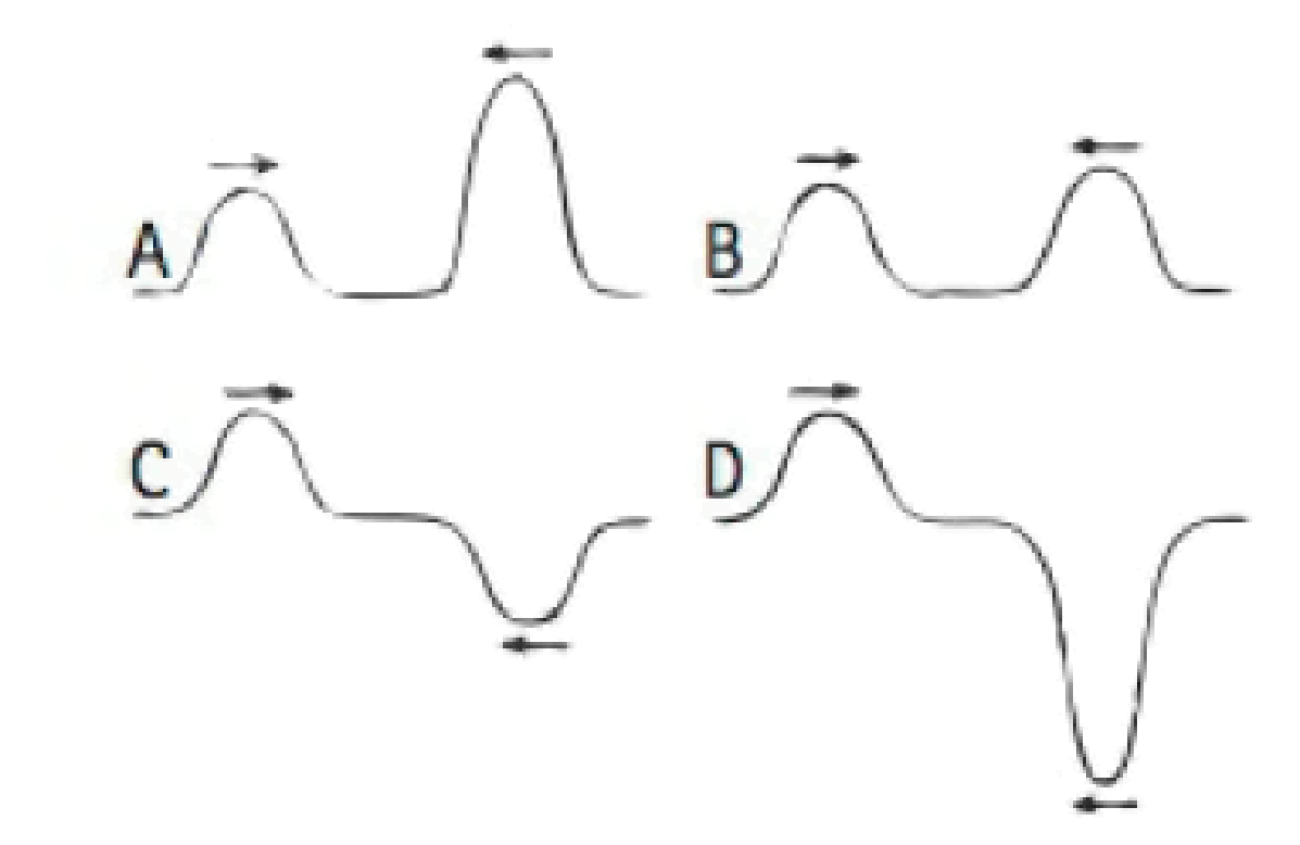 Chapter 10, Problem 62TAR, Four different pairs of transverse wave pulses move toward each other. At some point in time, the 
