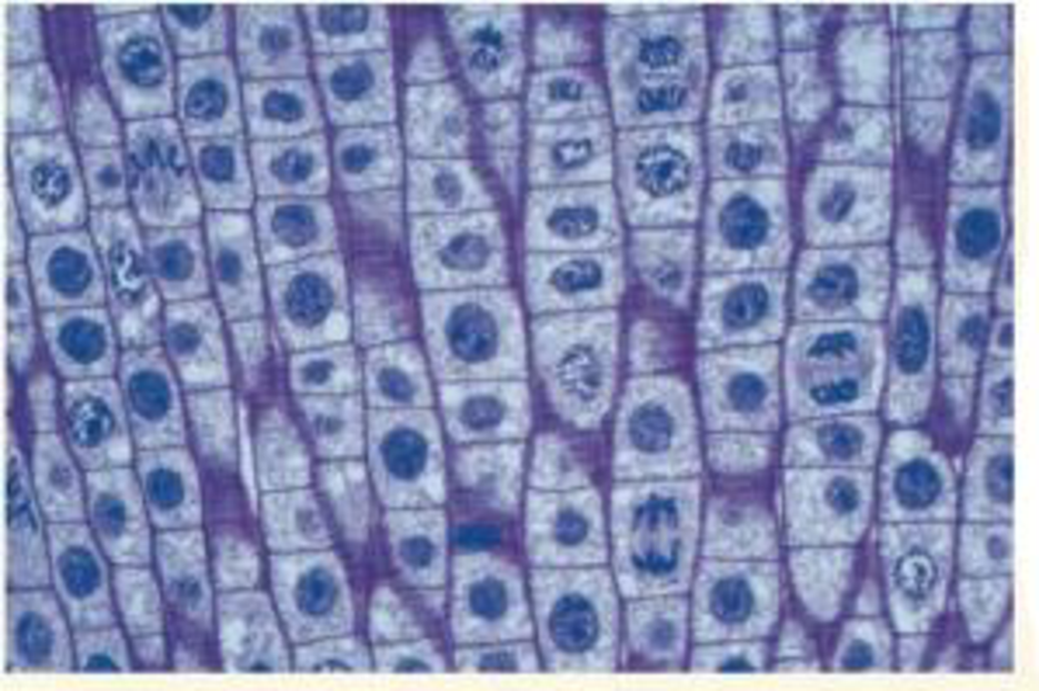 Chapter 12, Problem 9TYU, VISUAL SKILLS The light micrograph shows dividing cells near the tip of an onion root. Identify a 
