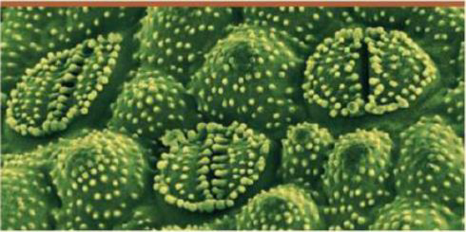 Chapter 29, Problem 10TYU, SYNTHESIZE YOUR KNOWLEDGE These stomata are from the leaf of a common horsetail. Describe how 