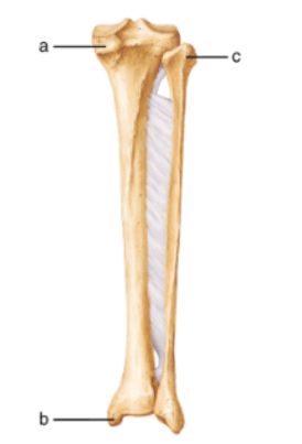 Chapter 7, Problem 31CYU, What lower limb bone is the second largest bone in the body? 