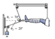 Chapter 5, Problem 40P, Patients with severe leg breaks arc often placed in traction, with an external force countering 