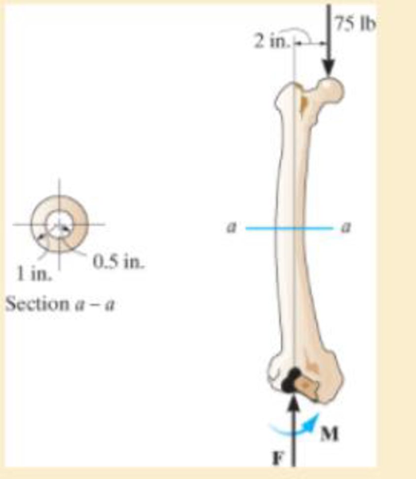Chapter 8, Problem 8.82RP, If the cross section of the femur at section aa can be approximated as a circular tube as shown, 