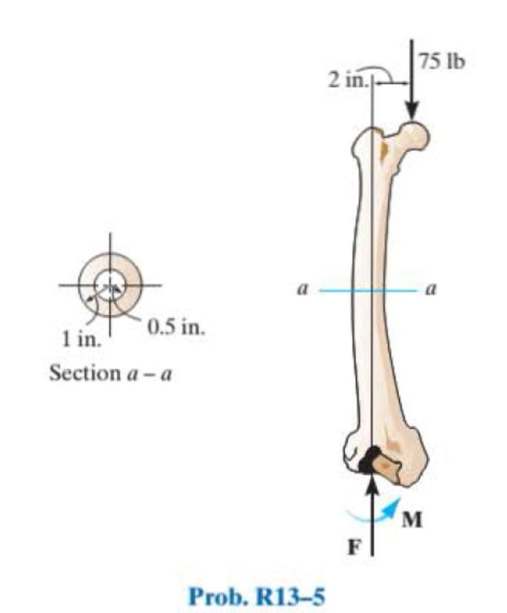 Chapter 13, Problem 5RP, If the cross section of the femur at section aa can be approximated as a circular tube as shown, 