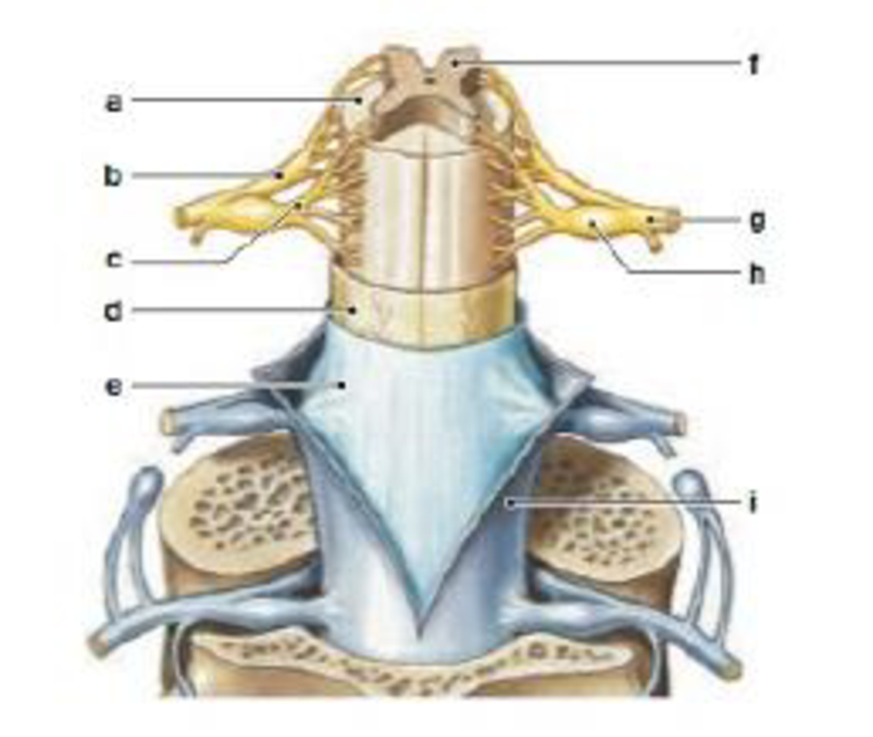 Chapter 13, Problem 1RQ, LEVEL 1 Reviewing Facts and Terms 1. Label the anatomical structures of the spinal cord in the 