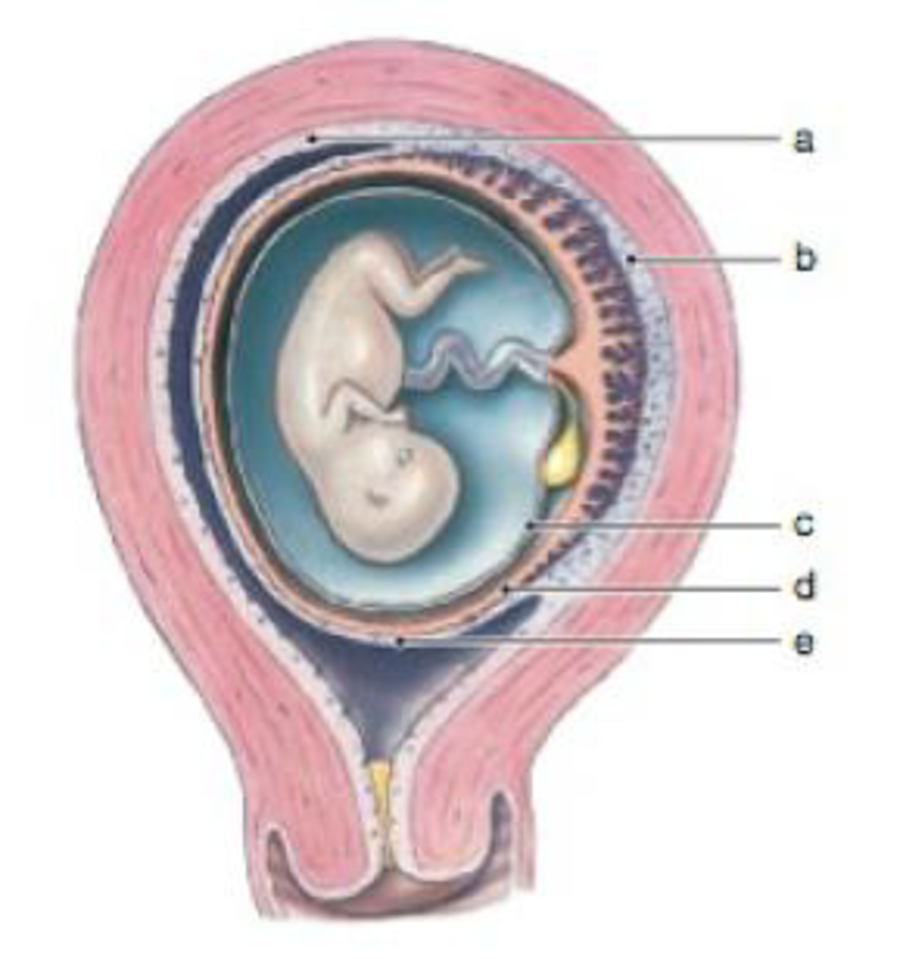 Chapter 29, Problem 2RQ, Identify the two extra-embryonic membranes and the three different regions of the endometrium at 