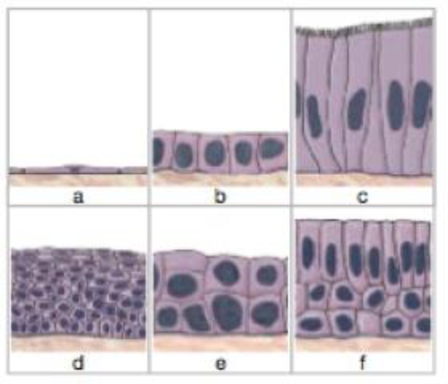 Chapter 4, Problem 1RQ, LEVEL 1 Reviewing Facts and Terms 1. Identify the six types of epithelial tissue shown in the 