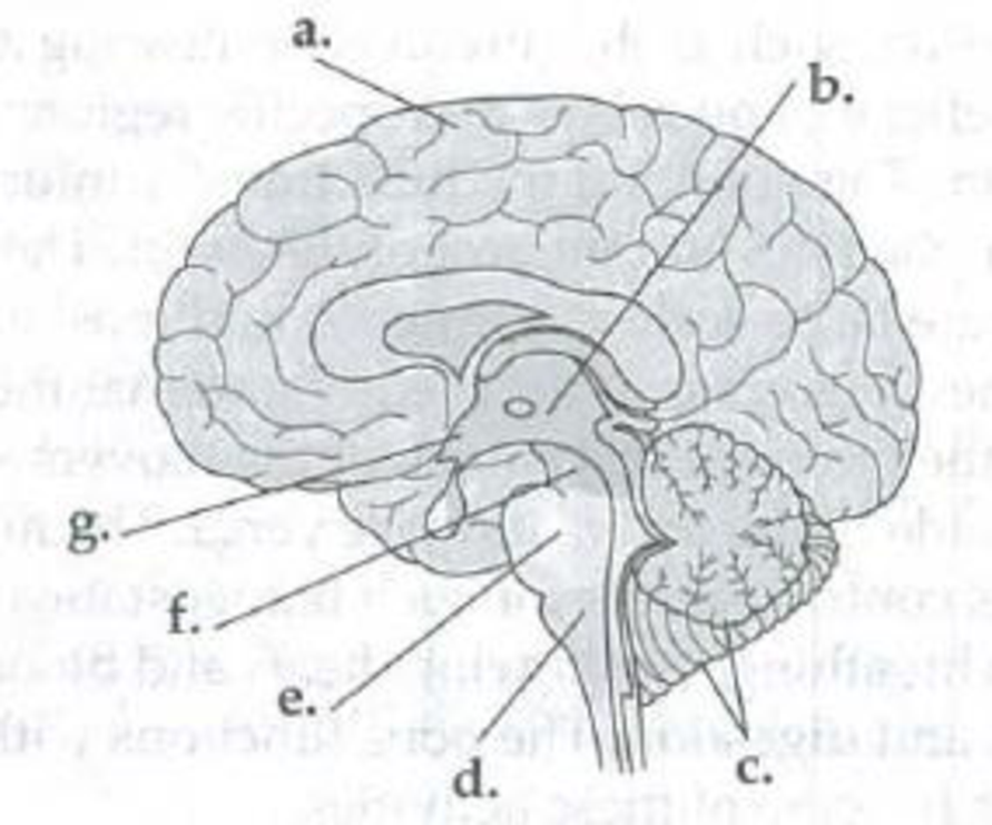 Chapter 49, Problem 4IQ, Identify the structures (a-g) in the following illustration of the human brain. Then match the , example  1