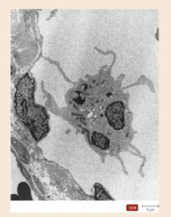 Chapter 16, Problem 2VI, The nearby image is a transmission electron micrograph of a dendritic cell. Indicate where a 