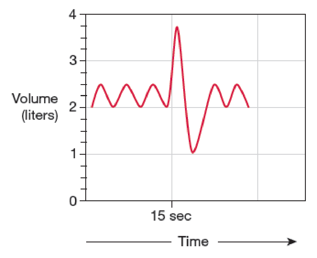 Chapter 17, Problem 11RQ, Refer to the spirogram in the following figure: a. Label tidal volume (VT), inspiratory and 