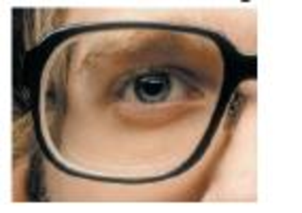 Chapter 19, Problem 14CQ, Is the wearer of the glasses in Figure Q19.14 nearsighted or farsighted? How can you tell? Figure 