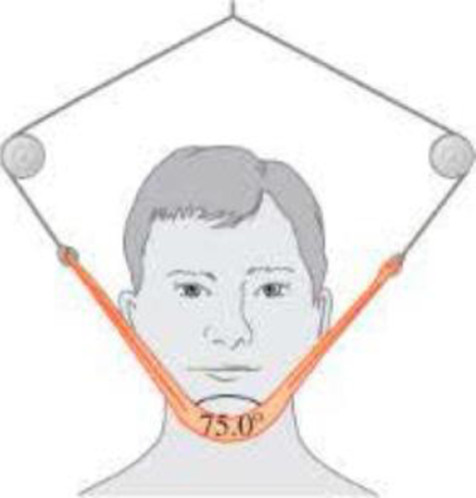 Chapter 4, Problem 4P, | BIO Jaw injury. Due to a jaw injury, a patient must wear a strap (see Figure 4.36: that produces a 
