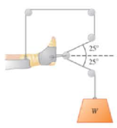 Chapter 5, Problem 8P, | BIO Traction apparatus. In order to prevent muscle contraction from misaligning bones during 