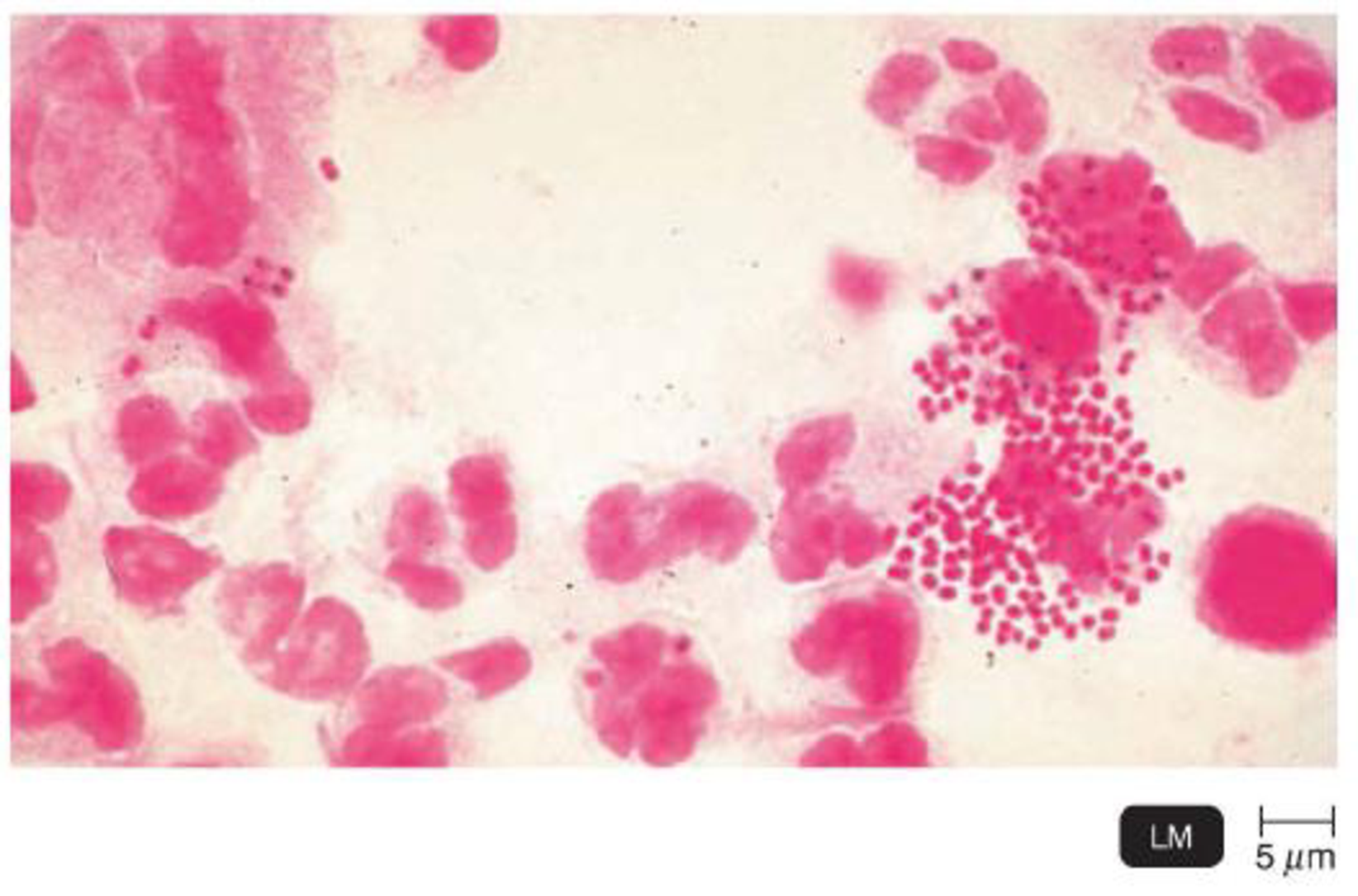 Chapter 3, Problem 2CAE, Laboratory diagnosis of Neisseria gonorrhoeae infection is based on microscopic examination of 