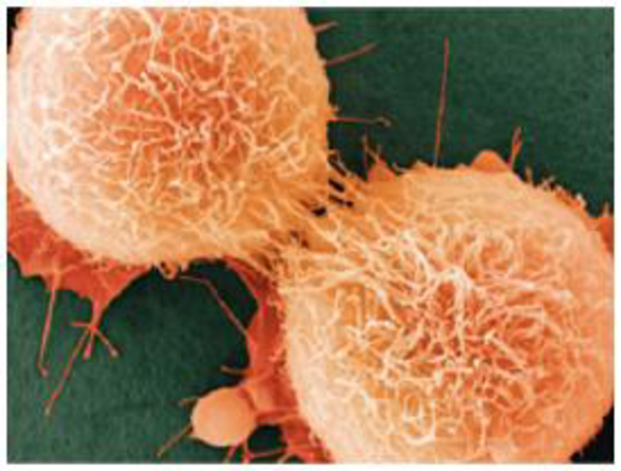 Chapter 9, Problem 11TYU, SYNTHESIZE YOUR KNOWLEDGE Shown here are two He La cancer cells that are just completing 