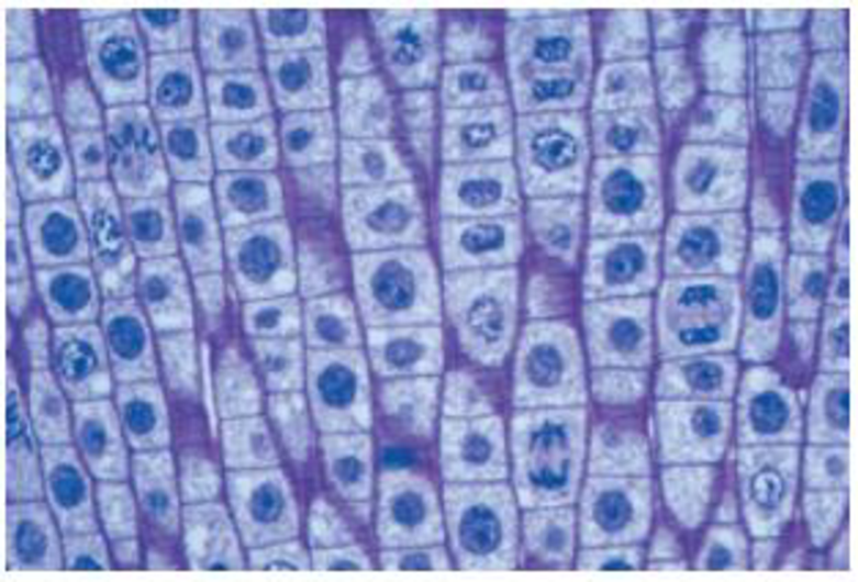Chapter 9, Problem 7TYU, The light micrograph shows dividing cells near the tip of an onion root. Identify a cell in each of 
