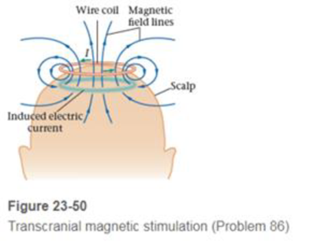 Chapter 23, Problem 86GP, BIO Transcranial Magnetic Stimulation Transcranial magnetic stimulation (TMS) is a noninvasive 