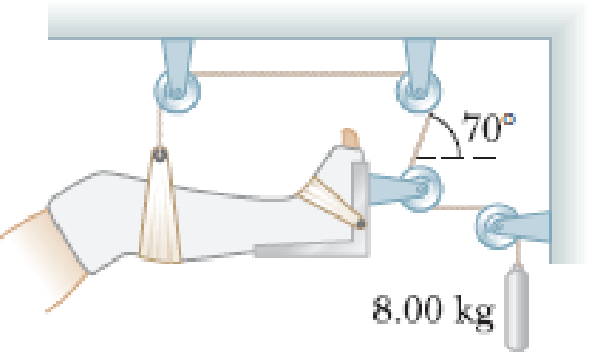 Chapter 4, Problem 20P, A setup similar to the one shown in Figure P4.20 is often used in hospitals to support and apply a 