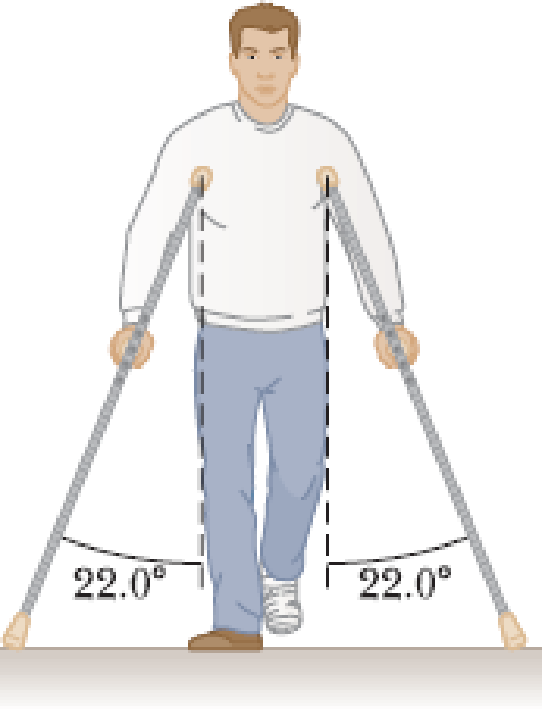 Chapter 5, Problem 6P, The person in Figure P5.6 weighs 170 lb. As seen from the front, each light crutch makes an angle of 
