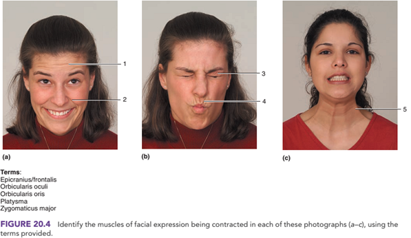 Chapter 20, Problem 3.1CT, Identify the muscles of various facial expressions in the photographs of figure 20.4. 1.. 