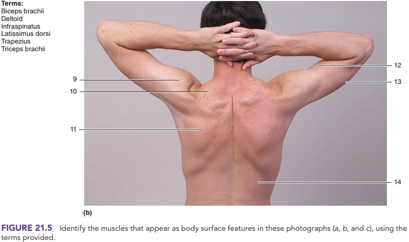 Chapter 21, Problem 3.1CT, Identify the muscles indicated in figure 21.5. . , example  2