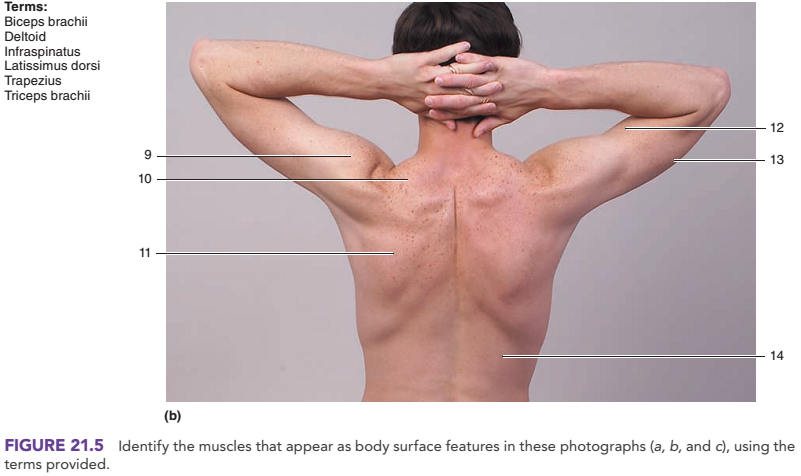 Chapter 21, Problem 3.2CT, Identify the muscles indicated in figure 21.5. , example  2