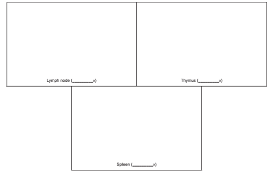 Chapter 42, Problem 4.1A, Sketch and label structural features of the following lymphatic organs: 