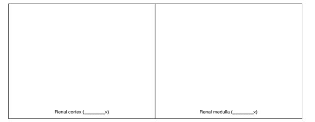 Chapter 48, Problem 3.1A, Sketch a representative section of the renal cortex and the renal medulla. Label the glomerulus, the 