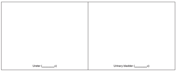 Chapter 48, Problem 4.1A, Sketch a cross section of a ureter. Label the three layers and the lumen. Sketch a segment of a 