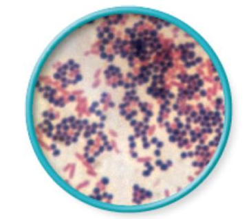 Chapter 3, Problem 1VC, From chapter 2, figure 2.18. Explain why some cells are pink and others are purple in this image of 