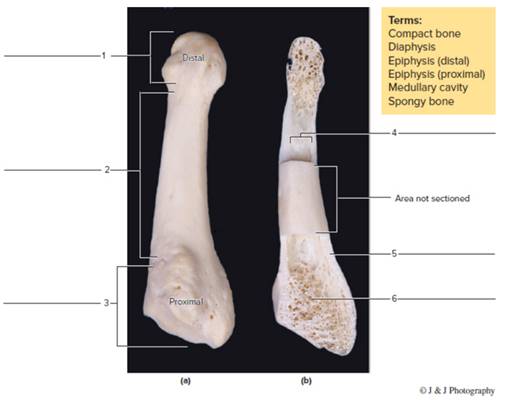 Chapter 12, Problem F12.10A, FIGURE 12.10 Identify the structures indicated in (a) the unsectioned long bone (fifth metatarsal) 