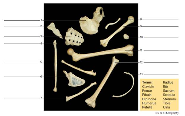 Chapter 13, Problem F13.4A, FIGURE 13.4 Identify the bones in this random arrangement, using the terms provided. 