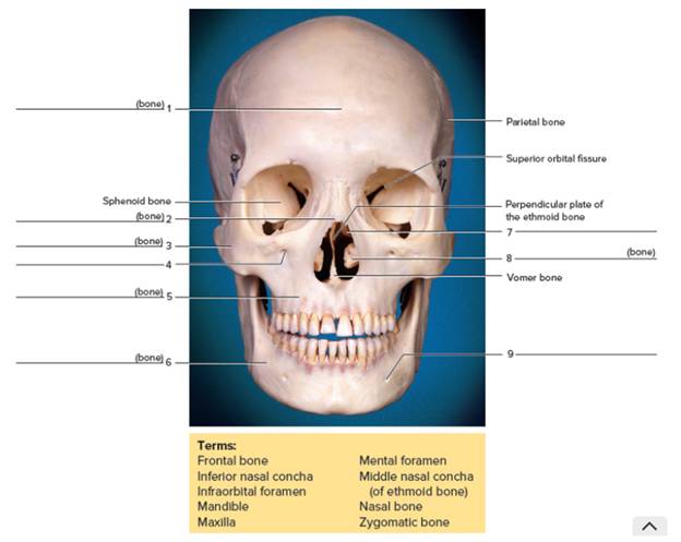 Chapter 14, Problem F14.10A, FIGURE 14.10 Identify the bones and features indicated on this anterior view of the skull, using the 