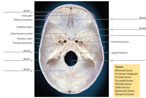 Chapter 14, Problem F14.13A, FIGURE 14.13 Identify the bones and features on this floor of the cranial cavity of a skull, using 