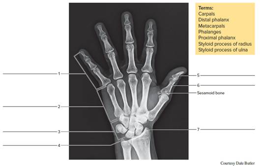 Chapter 16, Problem F16.10A, Identify the bones and features indicated in the radiographs of figures 16.8, 16.9, and 16.10. 