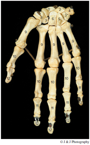 Chapter 16, Problem F16.12A, Identify the features of a humerus in figure 16.11 and the bones of the hand in figure 16.12. FIGURE 
