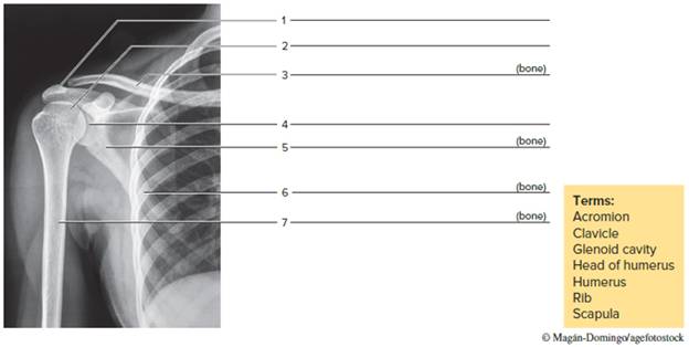 Chapter 16, Problem F16.9A, Identify the bones and features indicated in the radiographs of figures 16.8, 16.9, and 16.10. 