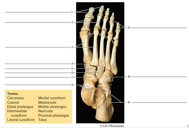 Chapter 17, Problem F17.10A, Identify the bones of the foot in figure 17.9, the features of a femur in figure 17.10 (page 176), 