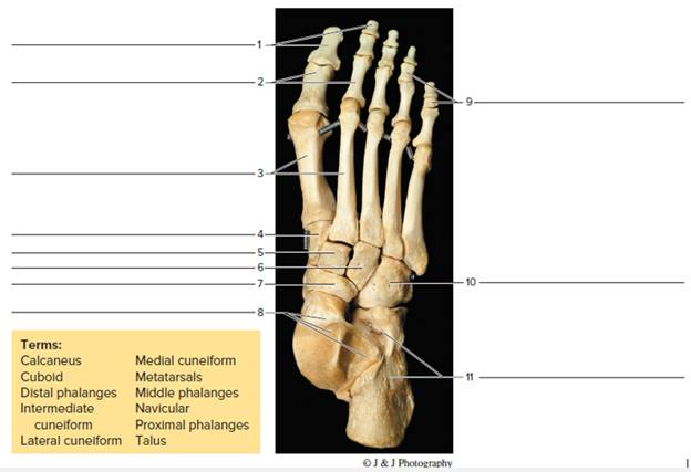 Chapter 17, Problem F17.9A, Identify the bones of the foot in figure 17.9, the features of a femur in figure 17.10 (page 176), 