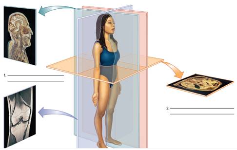 Chapter 2, Problem F2.12A, FIGURE 2.12 Label the planes of the sectioned (cut) body part. (1, 3) © McGraw-Hill Education/Karl 