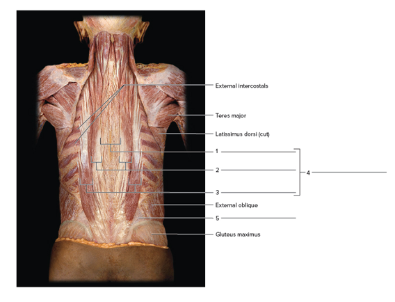 Chapter 24, Problem F24.5A, Label the deep back muscles of a cadaver, using the terms provided. The trapezius, latissimusdorsi, 