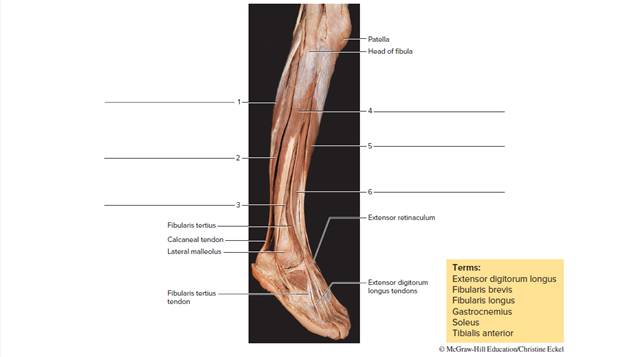 Chapter 25, Problem F25.11A, Label the right leg muscles of a cadaver, lateral view, using the terms provided. 