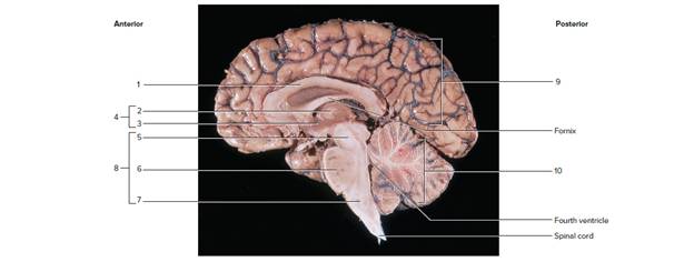 Chapter 30, Problem F30.13A, Identify the features indicated in the median section of the right half of the human brain in figure 