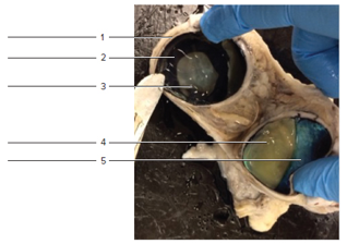 Chapter 35, Problem F35.14A, Partial frontal cut of dissected cow eye. Label the internal structures using the list provided. 
