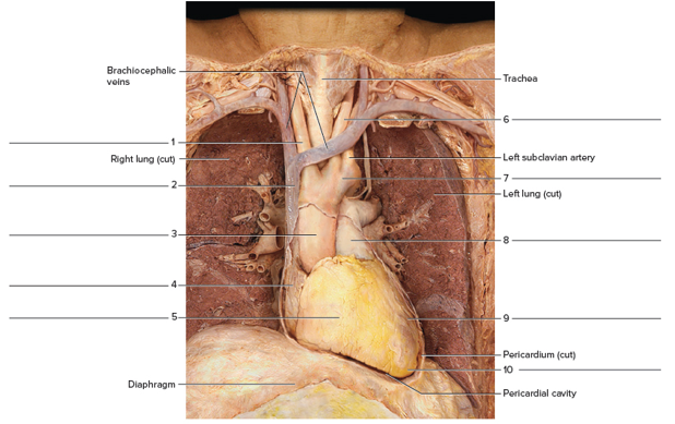 Chapter 44, Problem F44.13A, FIGURE 44.13 Identity the features on this anterior view of the heart region of a cadaver, using 