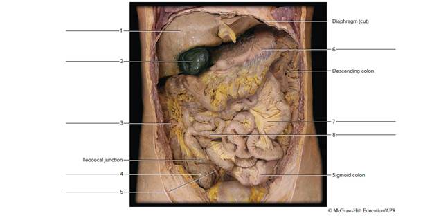 Chapter 54, Problem F54.19A, FIGURE 54.19 Label the digestive structures of this abdominopelvic cavity of a cadaver (anterior 